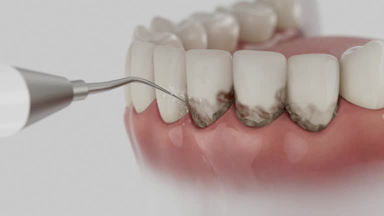 Reliable Emergency Dentist contractor in Wheaton, MD by Smile Center Dentistry